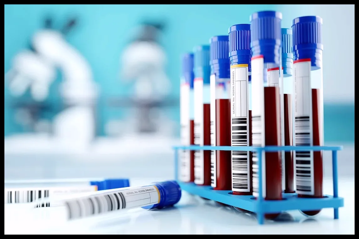 تست خون چندسرطانی گالری با وجود تردیدها مورد حمایت کمیته FDA قرار گرفت